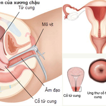 DỊCH VỤ SOI CỔ TỬ CUNG CHÂU LÊ