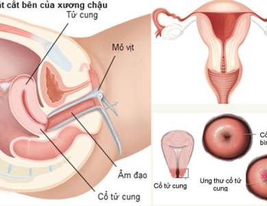 DỊCH VỤ SOI CỔ TỬ CUNG CHÂU LÊ